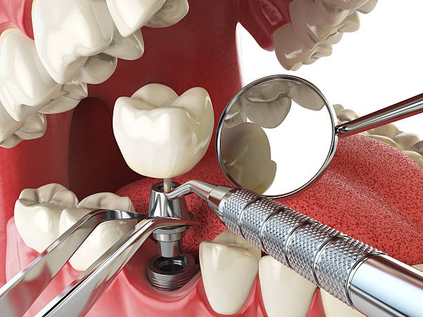 Best Weekend Emergency Dentist in Brookdale, NJ